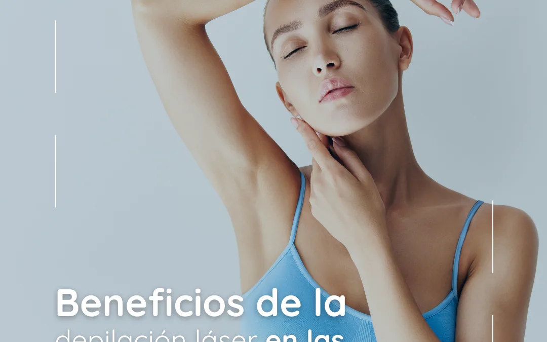 Beneficios de la depilación láser en las axilas
