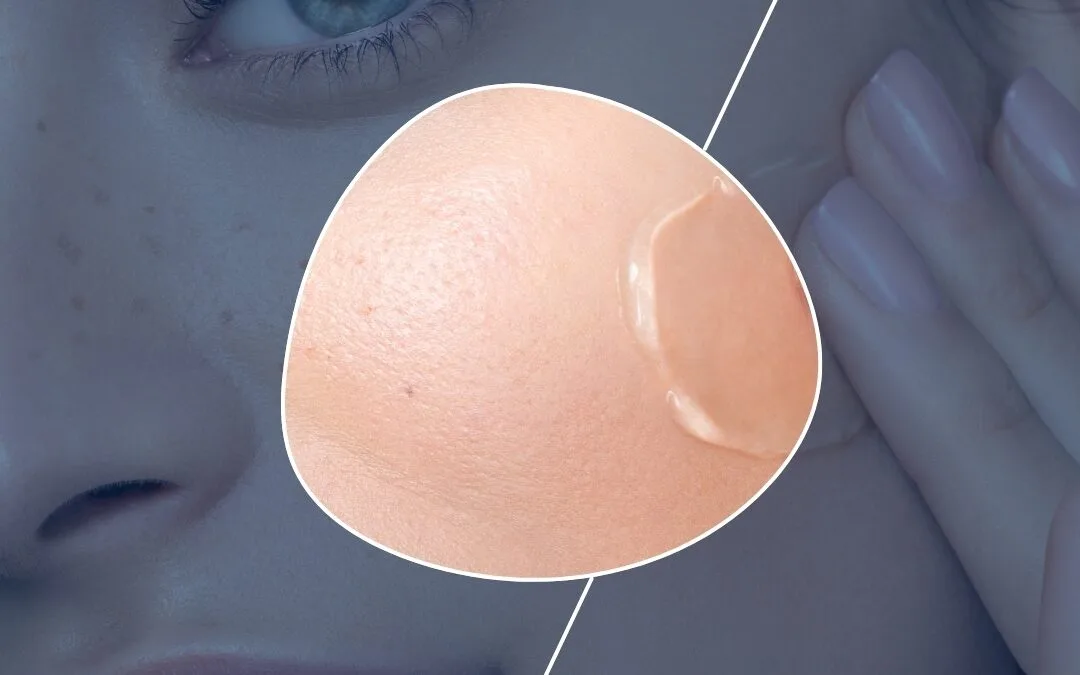 Tratamiento Skinbooster: ¿Qué es y cuándo usarlo?