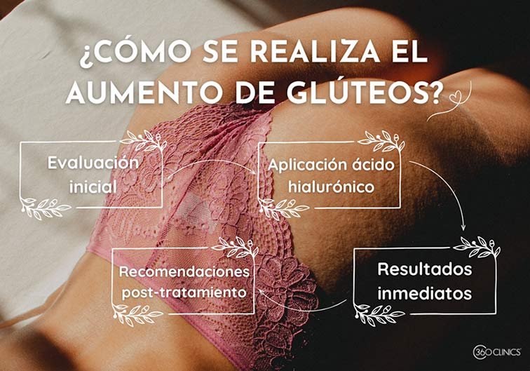 paso a paso del procedimiento del aumento de gluteos sin cirugia en 360Clinics