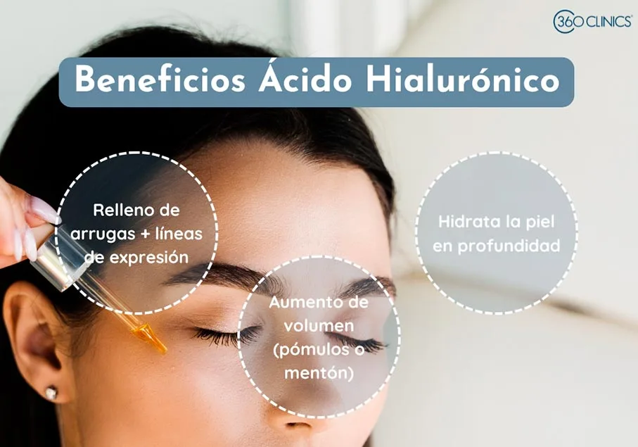 el ácido hialurónico sirve para hidratar la piel, rellenar arrugas y aumentar el volumen de la cara