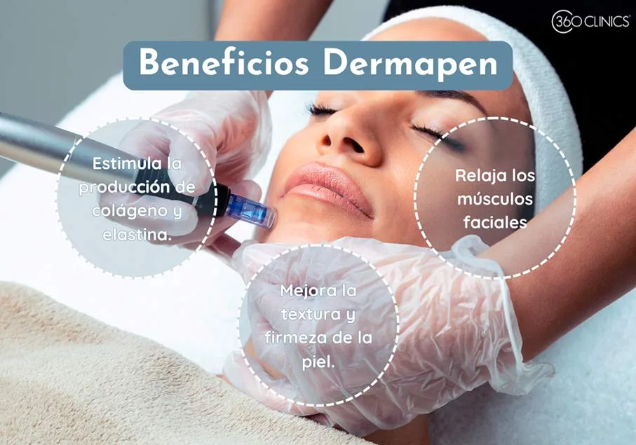 el dermapen es una tecnica de microneedling que ayuda a reducir marcas de acne, manchas y estimula la produccion de colageno