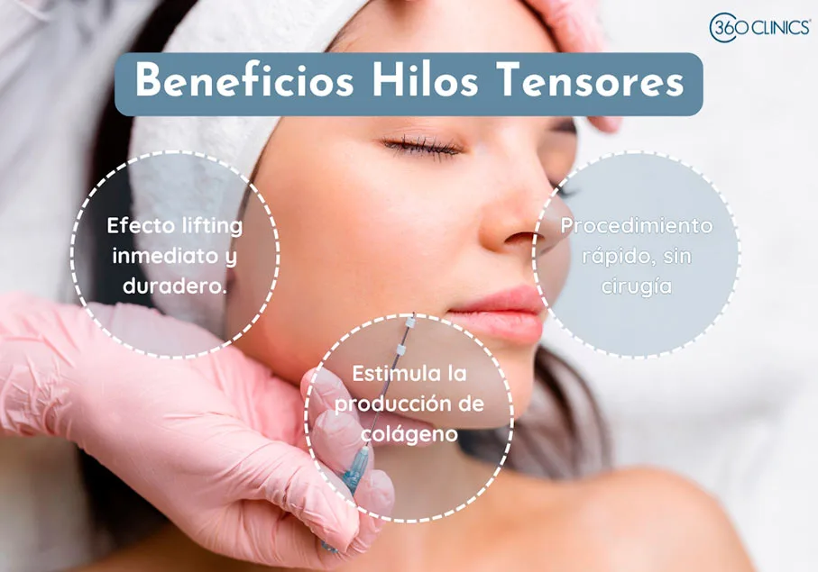 Los hilos tensores logran un efecto lifting facial sin cirugia, ademas de estimular la produccion de colageno