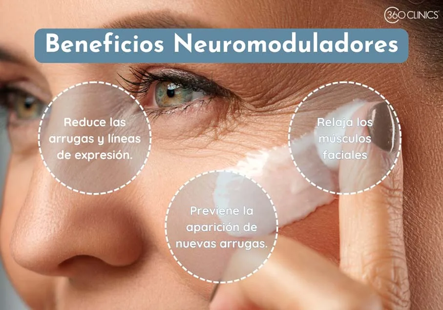 los neuromoduladores ayudan a rellenar y prevenir arrugas en la cara, ademas de relajar los musculos