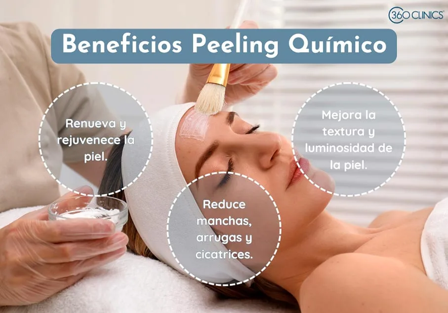 el peeling quimico es una tecnica de exfoliacion facial profunda que ayuda a reducir manchas, cicatrices y disminuir arrugas