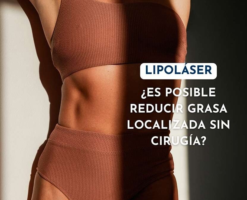 7 Preguntas Frecuentes sobre Liposucción Sin Cirugía